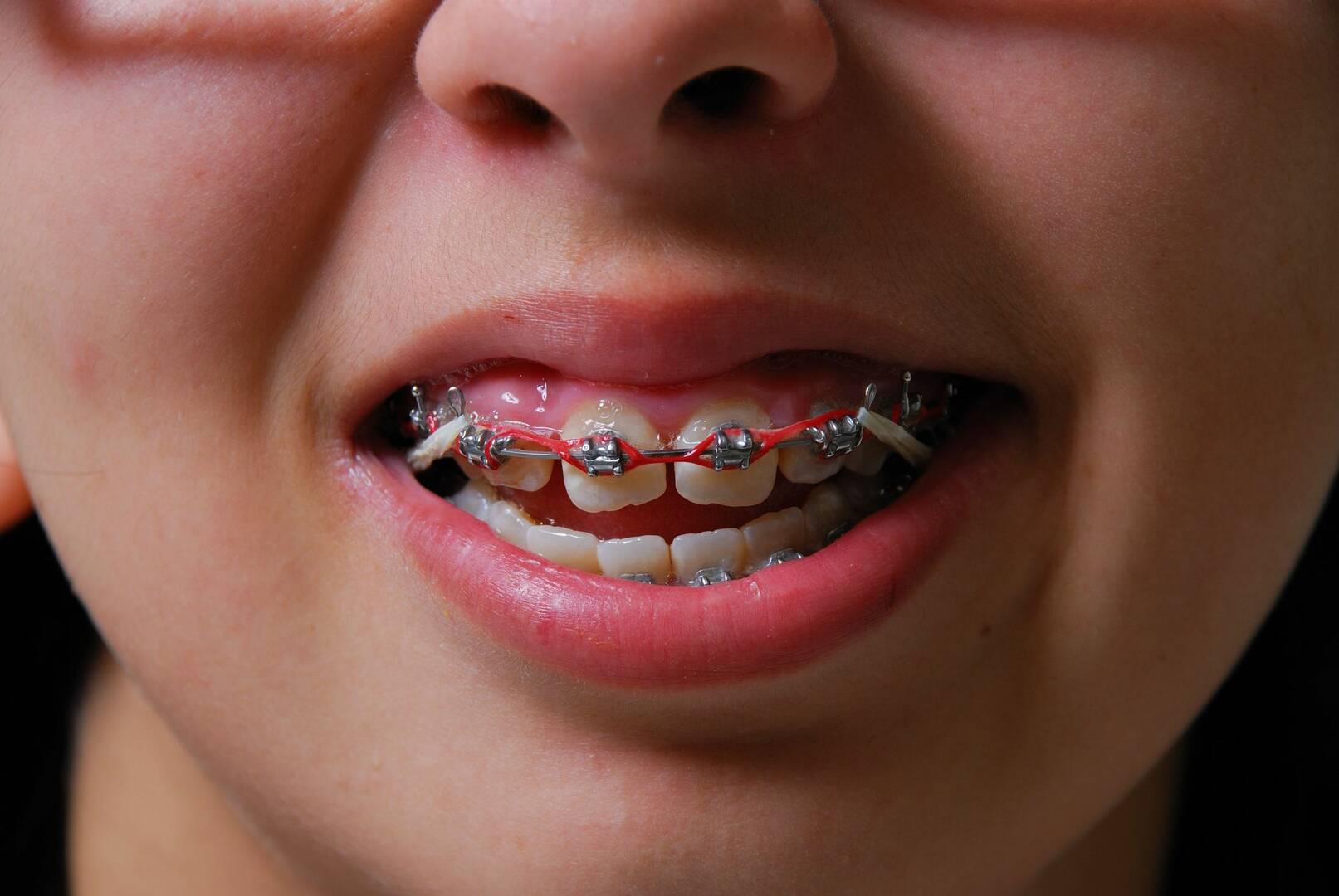 Gold Coast Dental and Denture Centre logo
